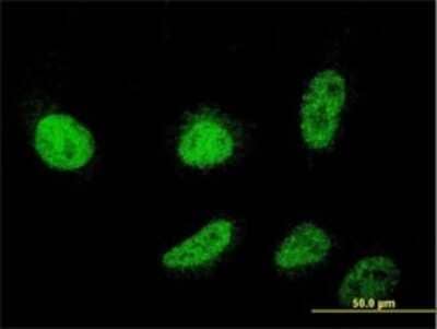 Immunocytochemistry/ Immunofluorescence: PIPPIN Antibody (2H8) [H00027254-M01]