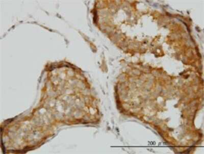 Immunohistochemistry-Paraffin: PIPPIN Antibody (2H8) [H00027254-M01]
