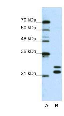 Western Blot: PIPPIN Antibody [NBP1-70673]