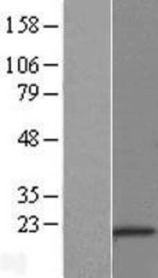 Western Blot: PIPPIN Overexpression Lysate [NBL1-09510]