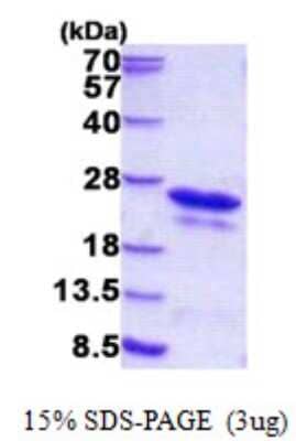 SDS-PAGE: Recombinant Human PIPPIN His Protein [NBP2-22792]