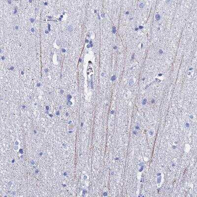 Immunohistochemistry-Paraffin: PIRT Antibody [NBP1-90968]