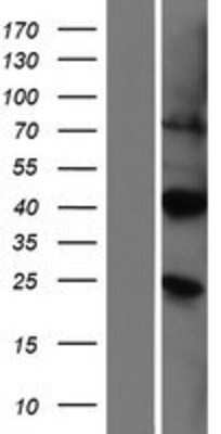 Western Blot: PIRT Overexpression Lysate [NBP2-09337]