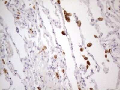 Immunohistochemistry: PISD Antibody (OTI4G5) [NBP2-46421]