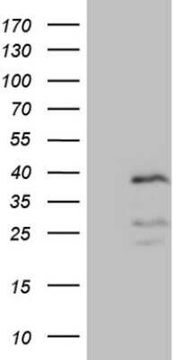 Western Blot: PISD Antibody (OTI4G5) [NBP2-46421]