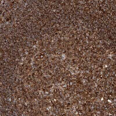 Immunohistochemistry-Paraffin: PISD Antibody [NBP1-84213]