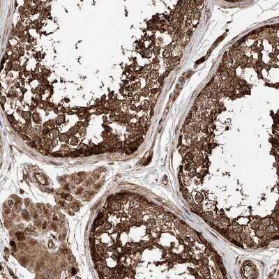Immunohistochemistry-Paraffin: PISD Antibody [NBP1-84213]