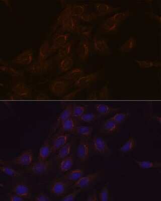 Immunocytochemistry/ Immunofluorescence: PIST Antibody (2B1P9) [NBP3-15280]