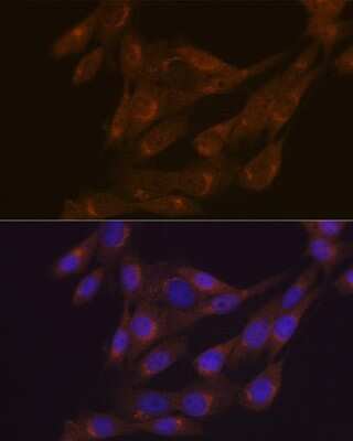 Immunocytochemistry/ Immunofluorescence: PIST Antibody (2B1P9) [NBP3-15280]