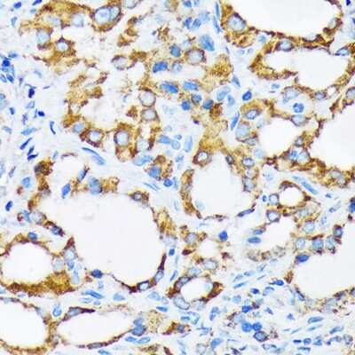 Immunohistochemistry-Paraffin: PIST Antibody (2B1P9) [NBP3-15280]