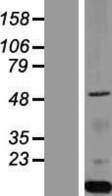 Western Blot: PIST Overexpression Lysate [NBP2-06654]