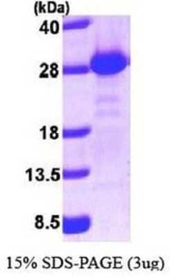 SDS-PAGE: Recombinant Human PIST His Protein [NBP1-40404]