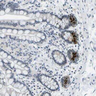 Immunohistochemistry-Paraffin: PITHD1 Antibody [NBP1-90717]