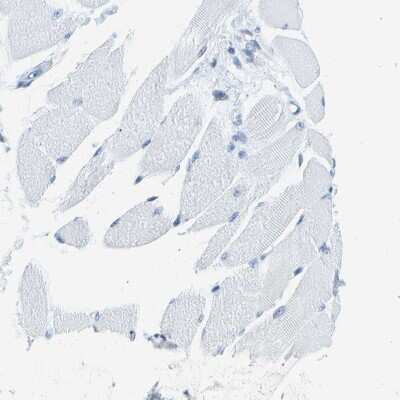Immunohistochemistry-Paraffin: PITHD1 Antibody [NBP1-90717]