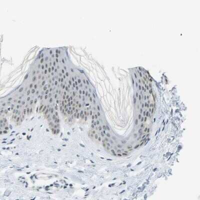 Immunohistochemistry-Paraffin: PITHD1 Antibody [NBP1-90717]