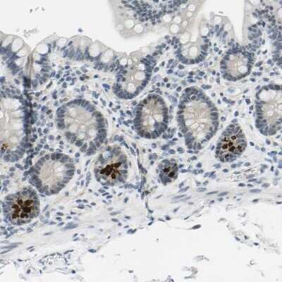 Immunohistochemistry-Paraffin: PITHD1 Antibody [NBP1-90717]