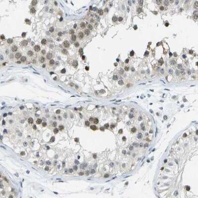 Immunohistochemistry-Paraffin: PITHD1 Antibody [NBP1-90717]