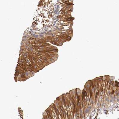 Immunohistochemistry-Paraffin: PITPNB Antibody [NBP1-86864]