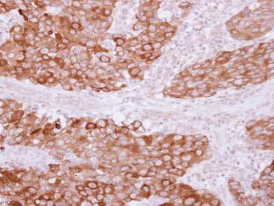Immunohistochemistry-Paraffin: PITPNB Antibody [NBP2-19841]