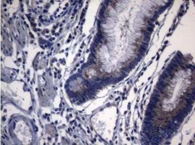 Immunohistochemistry: PITPNB Antibody (OTI6H10) - Azide and BSA Free [NBP2-73421]