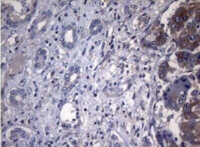 Immunohistochemistry: PITPNB Antibody (OTI6H10) - Azide and BSA Free [NBP2-73421]
