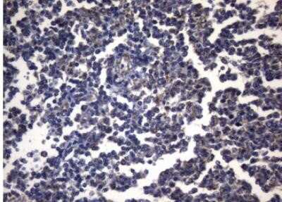 Immunohistochemistry: PITPNB Antibody (OTI6H10) - Azide and BSA Free [NBP2-73421]