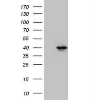 Western Blot: PITPNB Antibody (OTI6H10)Azide and BSA Free [NBP2-73421]