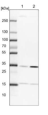 Western Blot: PITPNB Antibody [NBP1-86864]