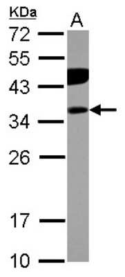 Western Blot: PITPNB Antibody [NBP2-19841]