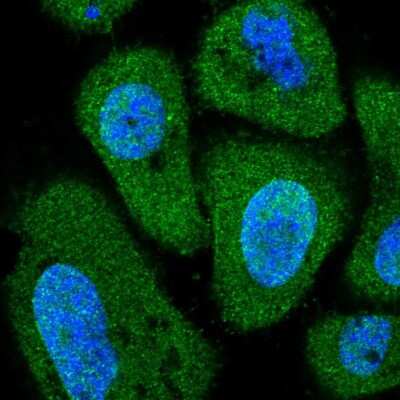 Immunocytochemistry/ Immunofluorescence: PITPNC1 Antibody [NBP2-58685]