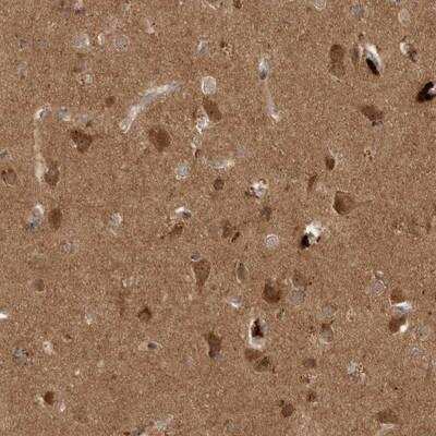 Immunohistochemistry-Paraffin: PITPNC1 Antibody [NBP1-80847]