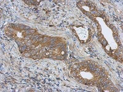 Immunohistochemistry-Paraffin: PITPNC1 Antibody [NBP2-19842]