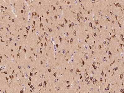 Immunohistochemistry-Paraffin: PITPNC1 Antibody [NBP2-97834]
