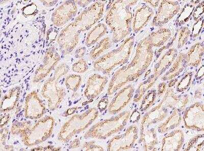 Immunohistochemistry-Paraffin: PITPNC1 Antibody [NBP2-97834]