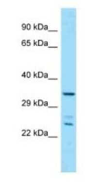 Western Blot: PITPNC1 Antibody [NBP1-98515]