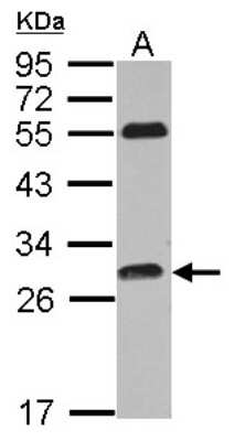 Western Blot: PITPNC1 Antibody [NBP2-19842]