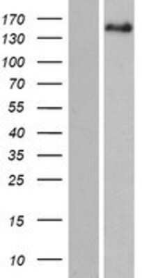 Western Blot: PITPNM2 Overexpression Lysate [NBP2-06600]