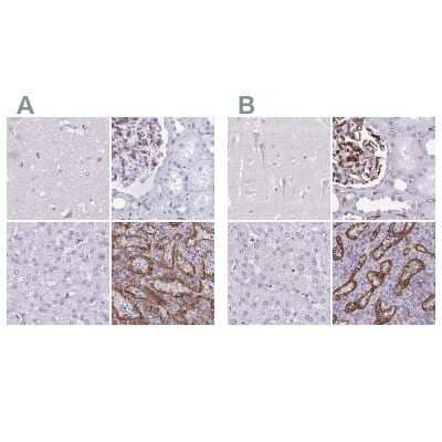Immunohistochemistry-Paraffin: PITPNM3 Antibody [NBP2-33894]