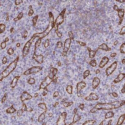 Immunohistochemistry-Paraffin: PITPNM3 Antibody [NBP2-34121]