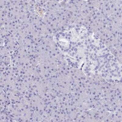 Immunohistochemistry-Paraffin: PITPNM3 Antibody [NBP2-34121]
