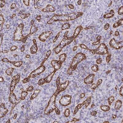 Immunohistochemistry-Paraffin: PITPNM3 Antibody [NBP2-34121]