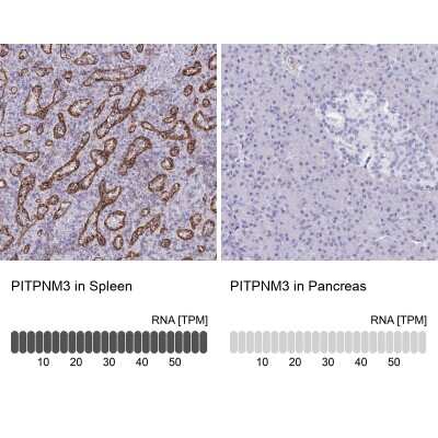Immunohistochemistry-Paraffin: PITPNM3 Antibody [NBP2-34121]