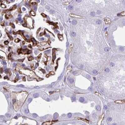 Immunohistochemistry-Paraffin: PITPNM3 Antibody [NBP2-34121]