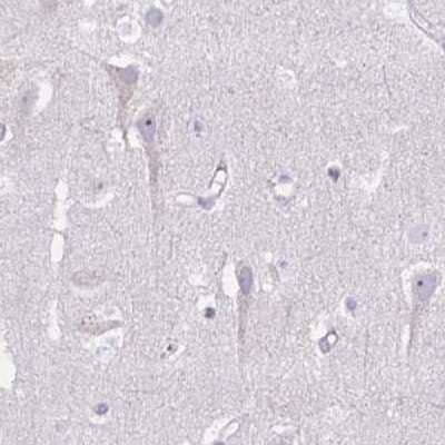 Immunohistochemistry-Paraffin: PITPNM3 Antibody [NBP2-34121]