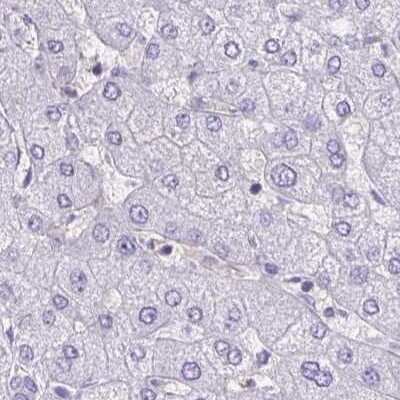 Immunohistochemistry-Paraffin: PITPNM3 Antibody [NBP2-34121]
