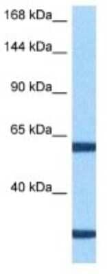 Western Blot: PITPNM3 Antibody [NBP3-10019]