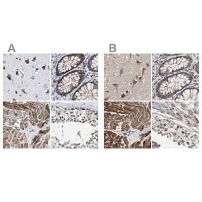 Immunohistochemistry-Paraffin: PITRM1 Antibody [NBP1-81728]