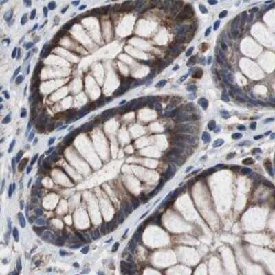 Immunohistochemistry-Paraffin: PITRM1 Antibody [NBP1-81728]