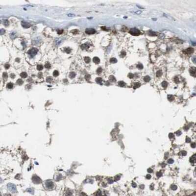 Immunohistochemistry-Paraffin: PITRM1 Antibody [NBP1-81728]