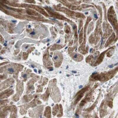 Immunohistochemistry-Paraffin: PITRM1 Antibody [NBP1-81728]